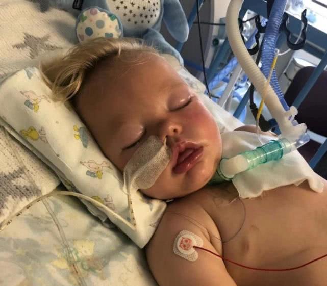 小孩被玻璃杯砸到头还出血怎么办,小孩拿杯子被割伤