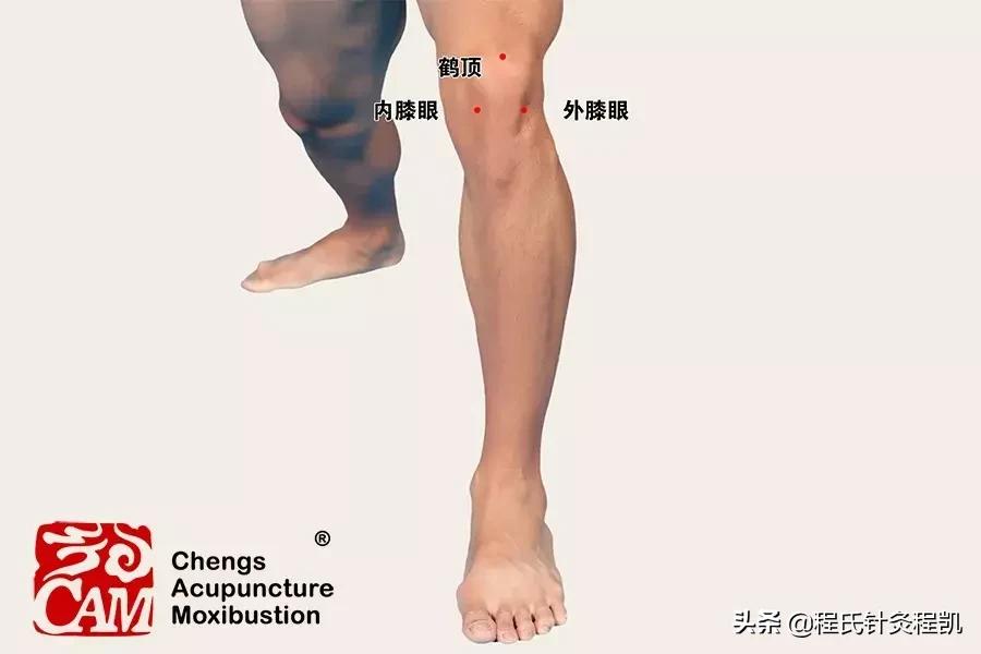 膝关节疼痛怎么办视频,膝关节疼痛怎么办