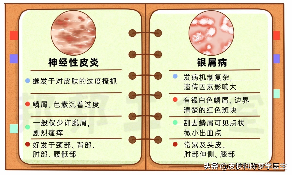 皮肤上的红斑可能是牛皮癣吗,红斑和脱屑的牛皮癣