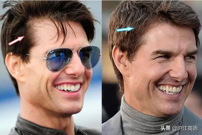 阿汤哥年轻时盛世美颜,阿汤哥整容失败