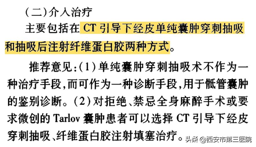 【医者解读】揭开“骶管囊肿”之神秘面纱，查出骶管囊肿都需要治疗吗？（手术病例+文献回顾）