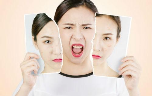 真正好用的祛痘霜,祛痘霜淡化痘印真实测评