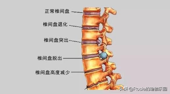 方领衣服肩带老是往下掉怎么办,穿衣服领口老是往下掉