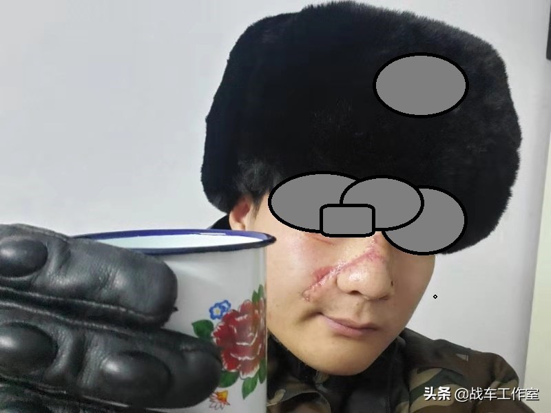 澶寸洈瀵硅溅鍙嬬殑褰卞搷,澶寸洈瀵硅溅鍙嬬殑鍗卞