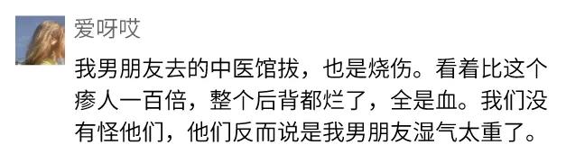 邓莎被烧伤原因,邓莎拔火罐被烧伤视频