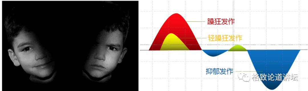 躁郁症误诊率,怎么判断得了躁郁症