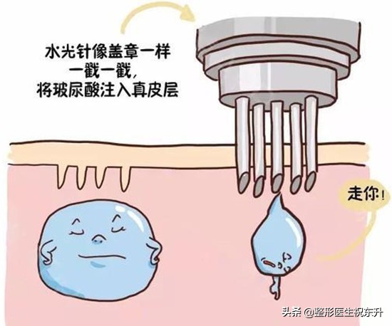 做过的来聊一聊，水光针能打吗？不太敢尝试...