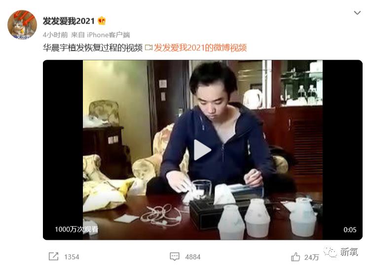 华晨宇整前整后对比,华晨宇最近又整脸了么