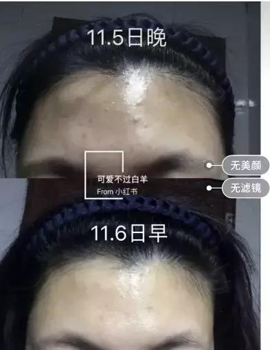 哪些护肤成分用了会脸黑,这些护肤行为可能会烂脸