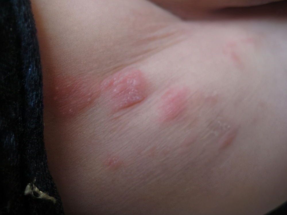 给孩子擦屁股用棉柔巾还是湿巾,给宝宝擦屁股用哪种湿巾