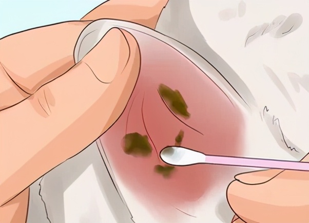 猫咪耳道问题不容忽视,猫咪的耳道分泌物很多怎么办