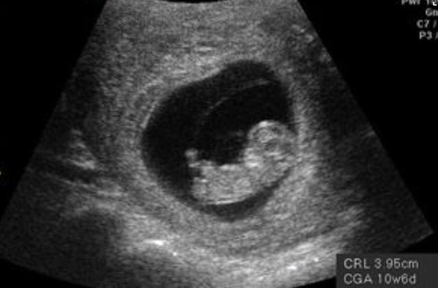 怀孕3到6个月时的反应,怀孕3个月和4个月的宝宝区别