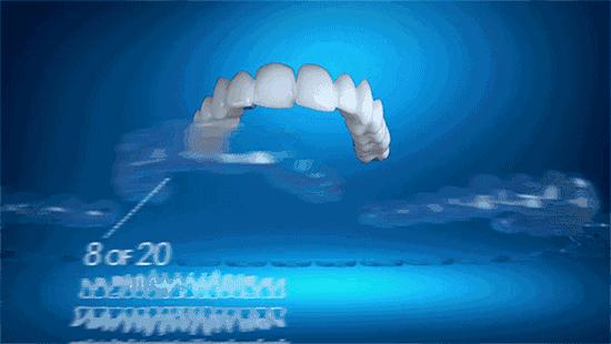 戴一个牙套牙会黑吗,戴个牙套有什么用处