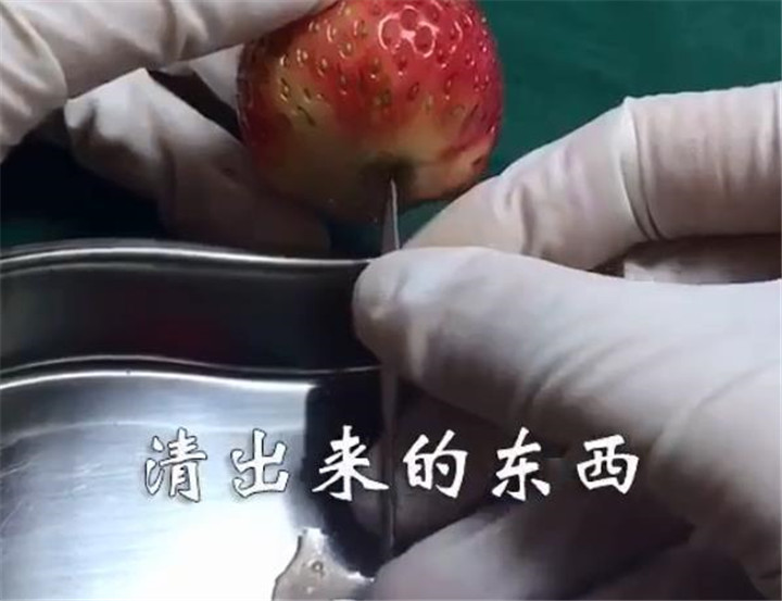 人流对女人伤害多大,人流对女性造成的伤害多久才会好