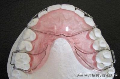 保持器怎么做微调,保持器该怎么选