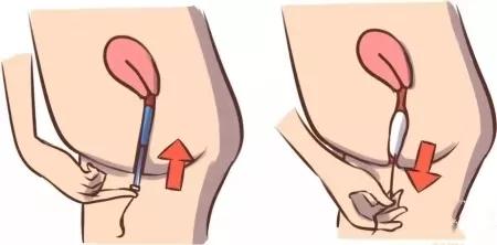 自己如何正确的找到盆底肌,改善盆底肌的正确方法