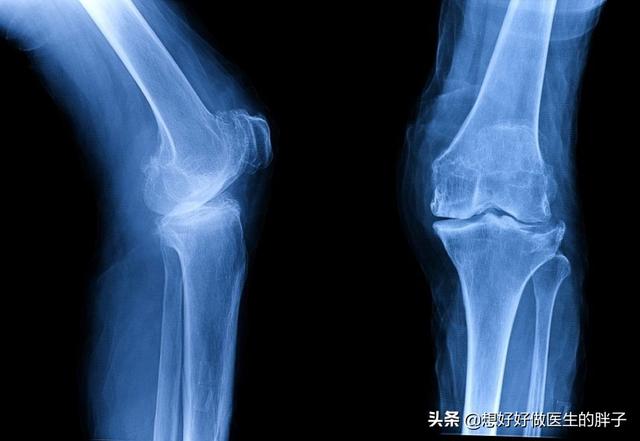 膝盖酸困无力是什么原因引起的,膝盖酸沉身体乏力是怎么回事啊