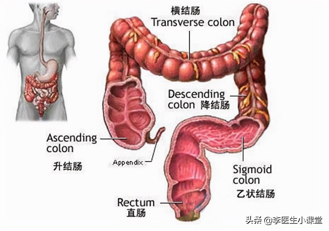 82岁老人便血半年检查肠癌,八十岁老人得肠癌总便血怎么办