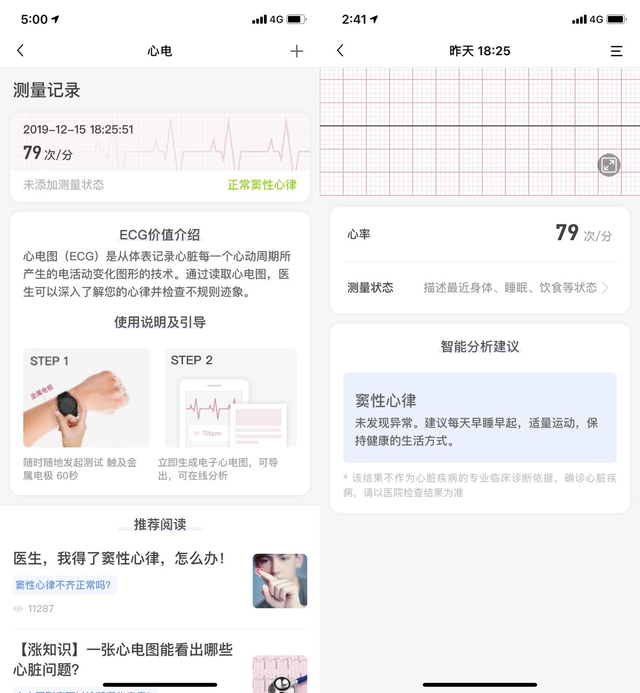 智能健康医疗级手表哪款好,乐心医疗级心电手表