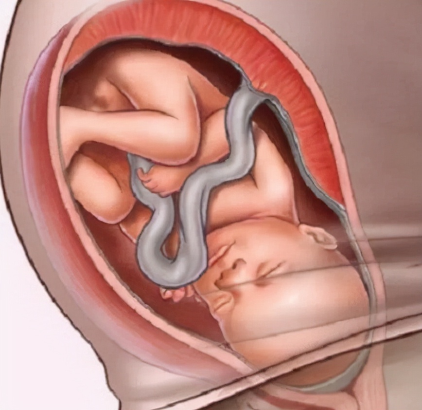 孕后期好害怕生产,孕后期担心胎儿健康