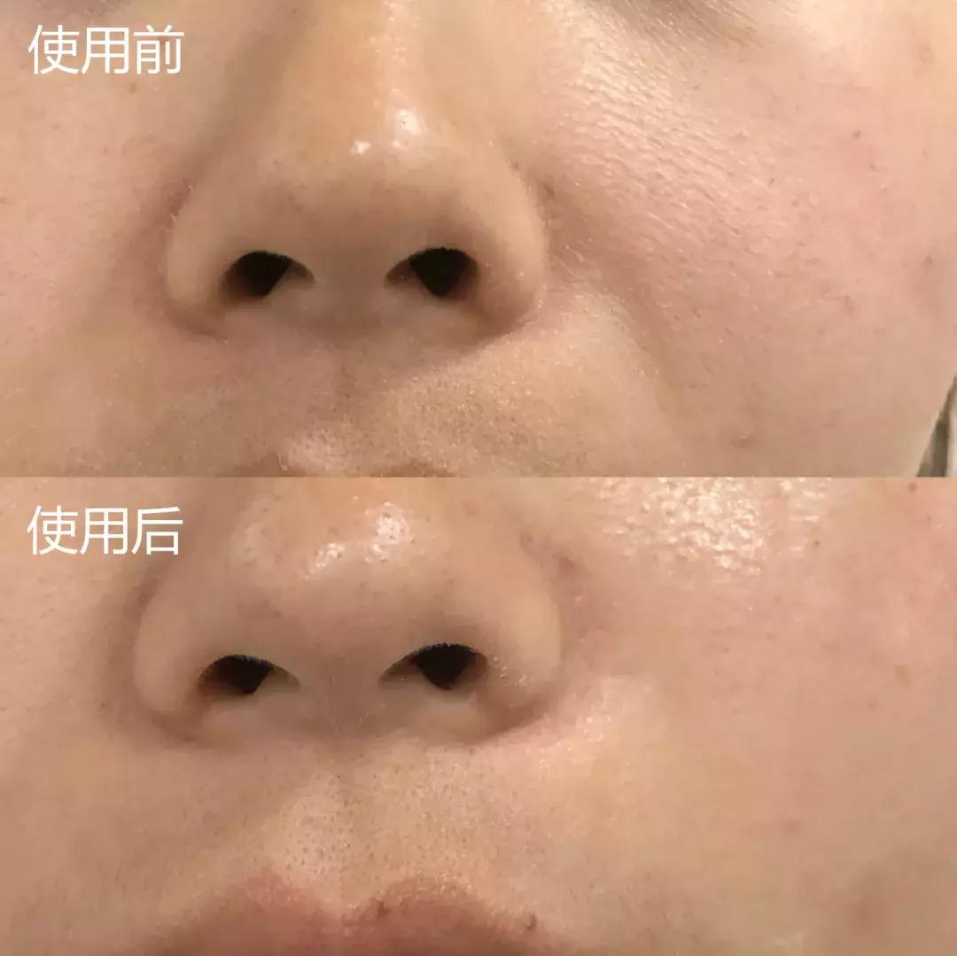 补水保湿淡化黑眼圈眼袋,黑眼袋黑眼圈用什么护肤品消除