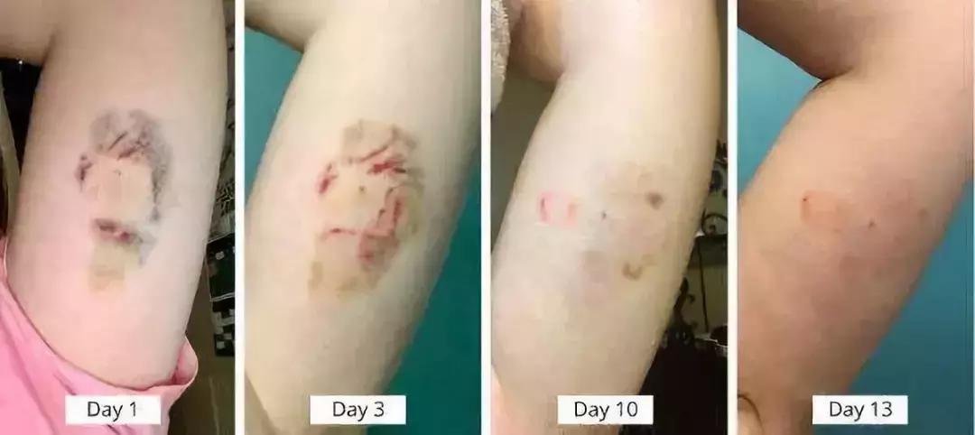 实际上的避孕手段,现在安全的避孕手段