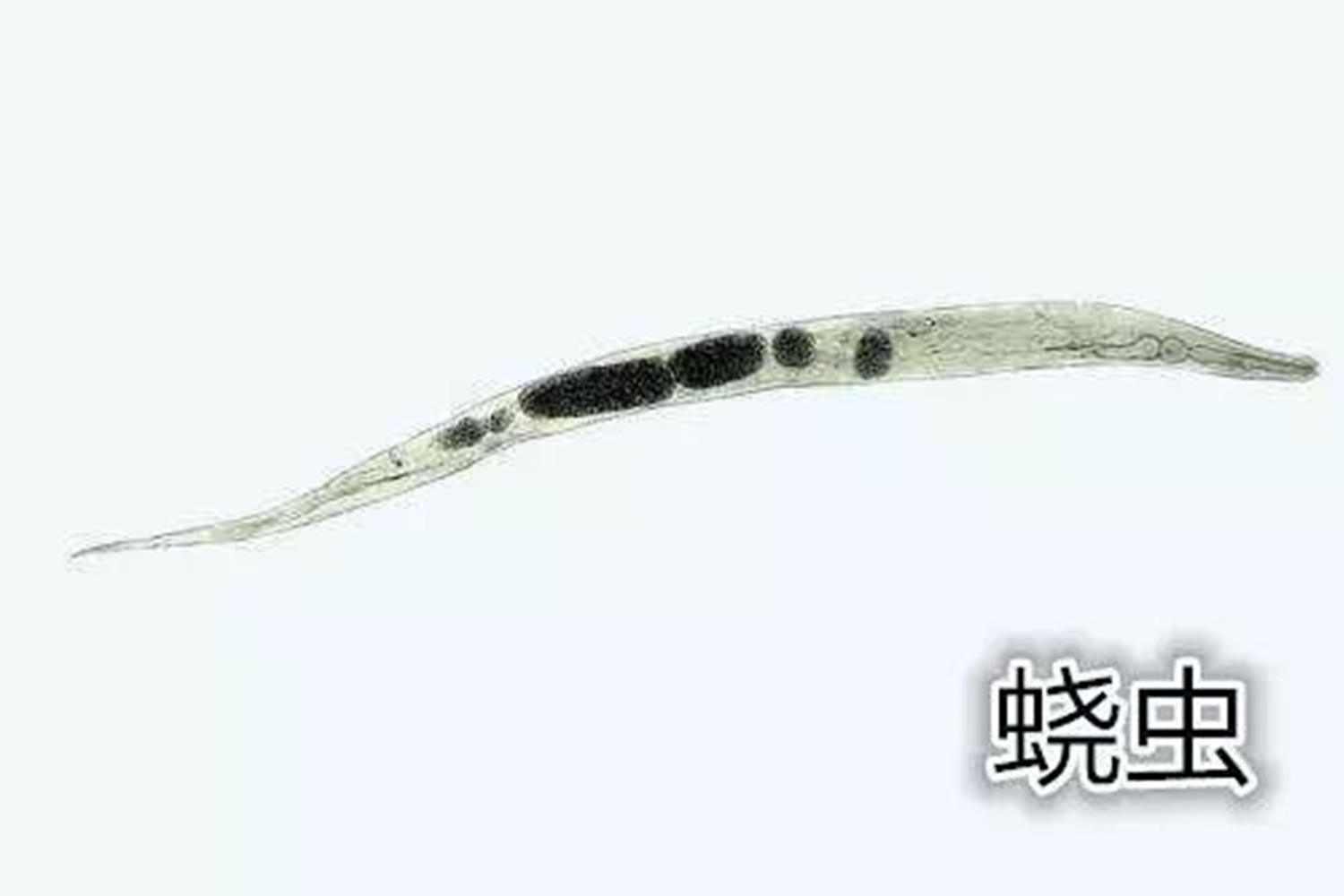 1岁宝宝半夜哭闹抓屁屁,四岁小孩总说屁痒