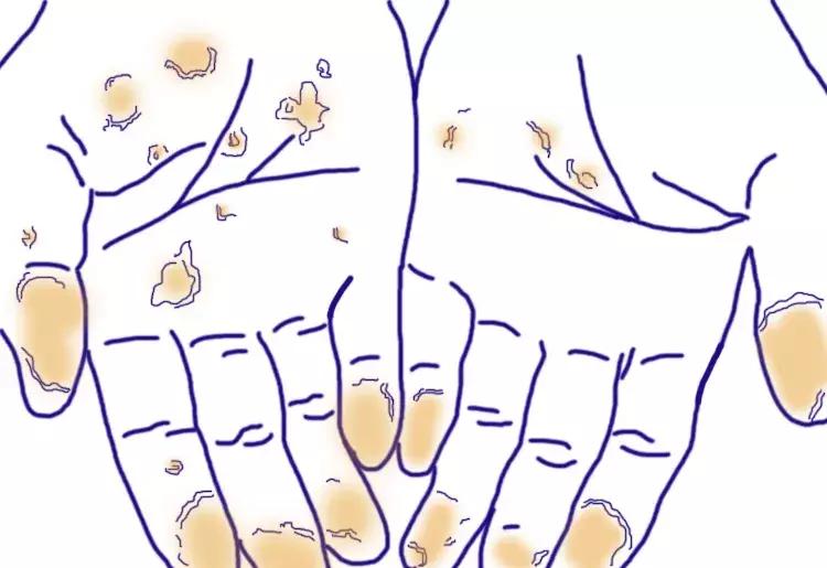 又到了一年一度手脱皮录不上指纹的日子