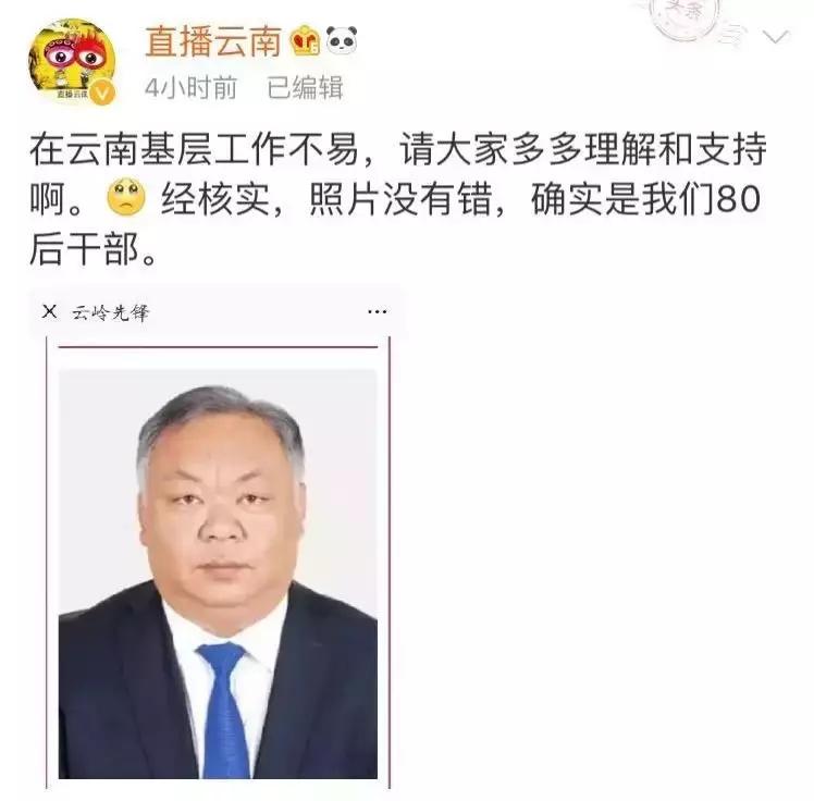 后天少白头原因,少白头和内分泌有关吗