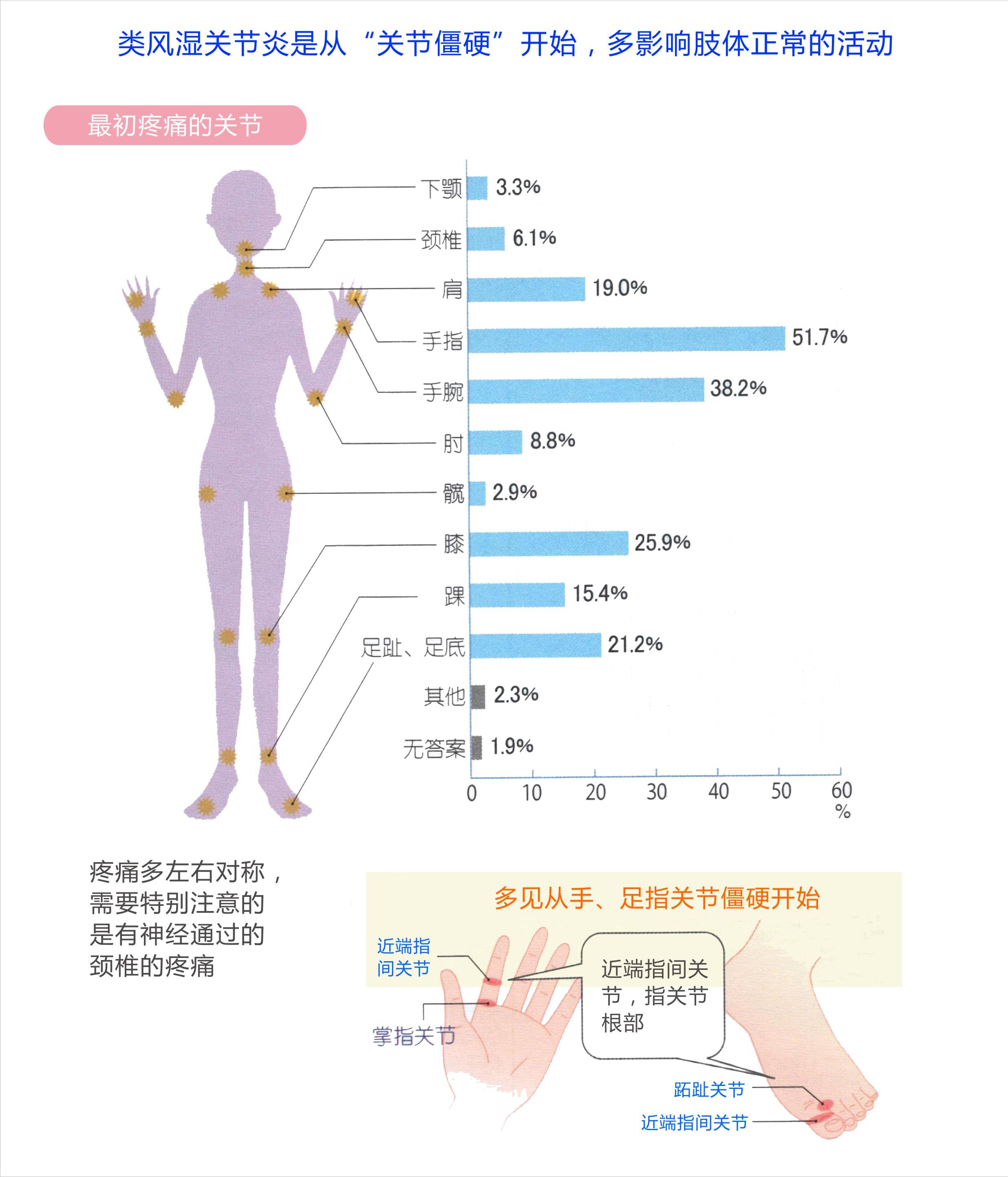 类风湿关节炎早期发现治疗能好吗,早期类风湿关节炎彻底治愈率