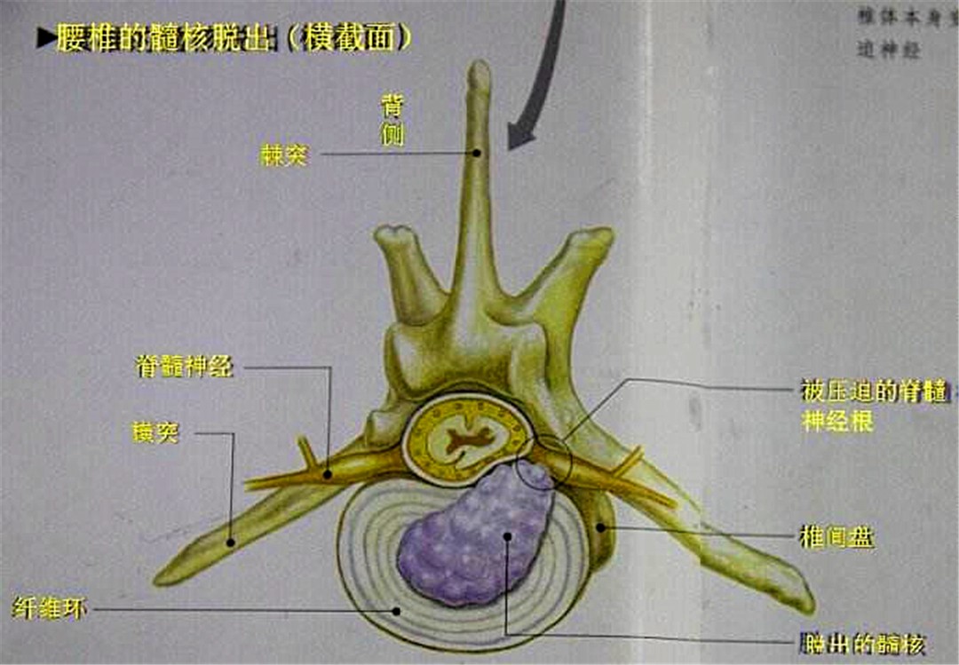 犬腰椎间盘疾病的部位,狗腰椎间盘突出的治疗方法