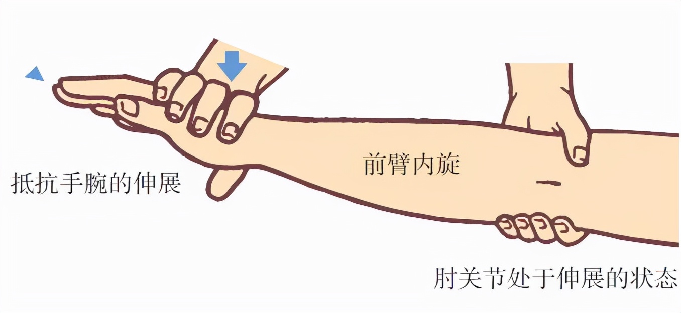 网球肘引起手臂疼痛用什么药治疗,有一种胳膊痛叫网球肘