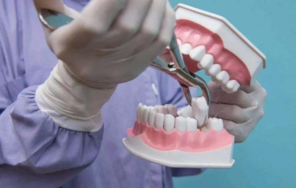 拔牙过后一直麻是对的吗,拔牙之后一直疼