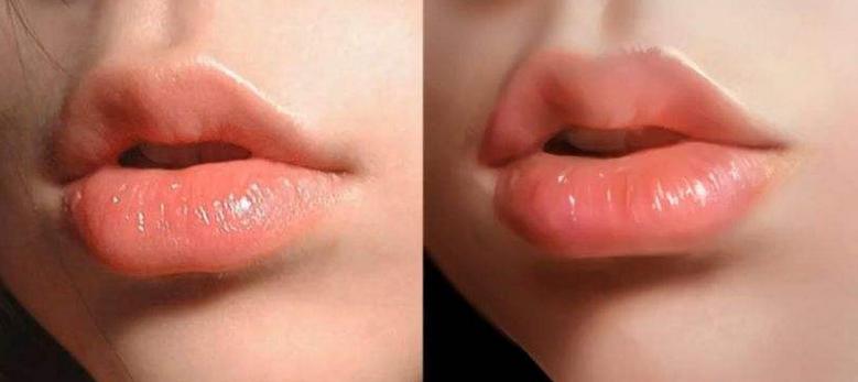 皮肤特别干燥有皱纹咋办,皮肤干燥有细纹的女人吃什么护肤