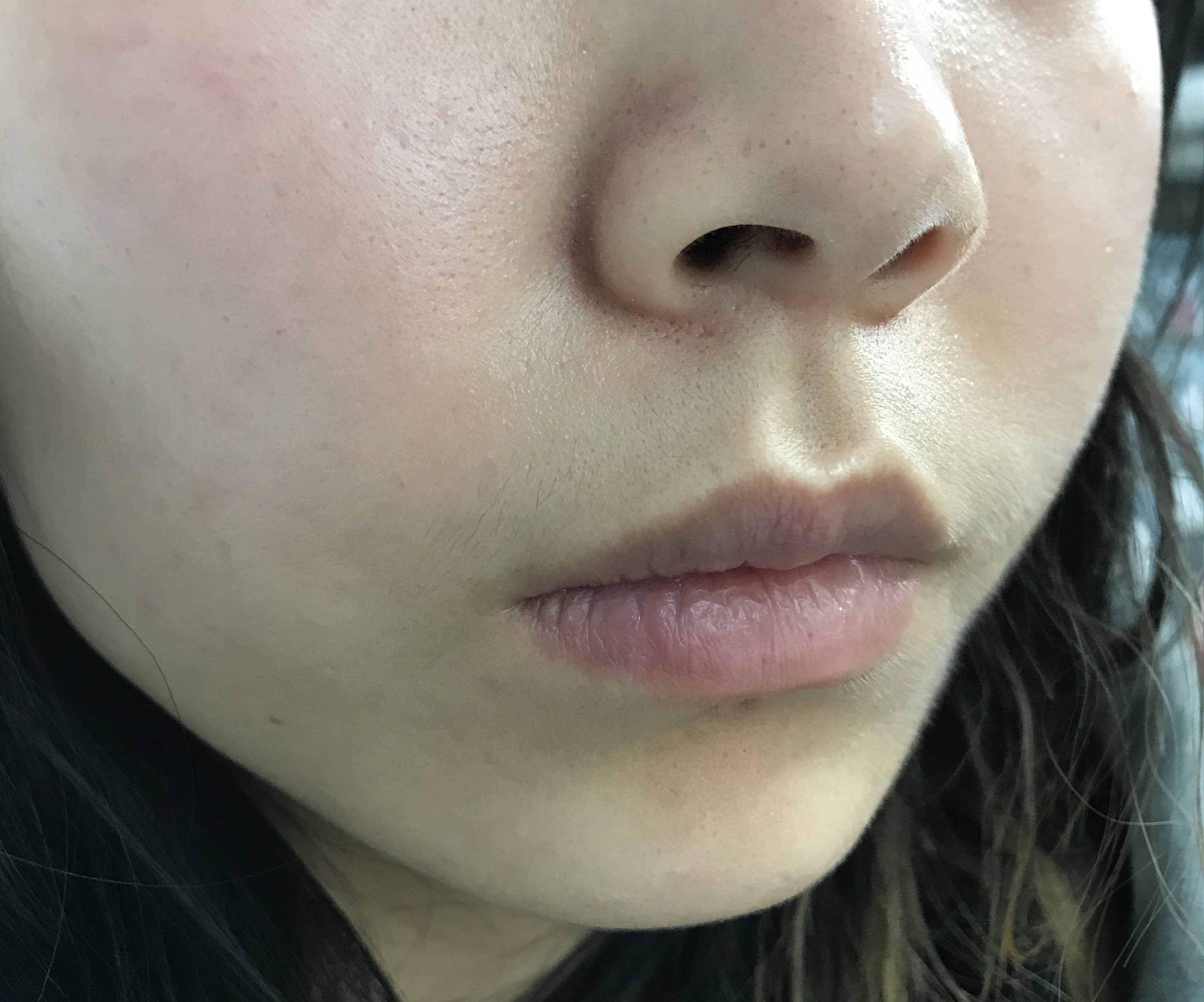 医美收毛孔价格表,医美收毛孔什么方法好