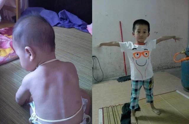 孩子饭量不大为什么还会胖,小孩饭量大不吸收营养怎么回事