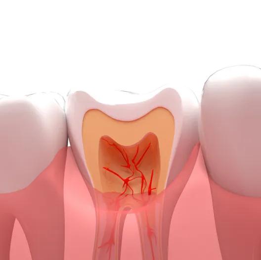 白天不牙疼为啥一到晚上就疼,老是晚上牙疼厉害睡不了觉