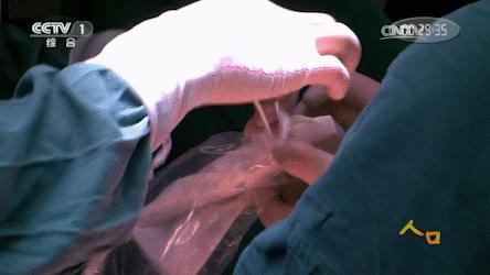 央视：打破“魔咒”，冻死癌细胞，胰腺癌治疗迎来新希望