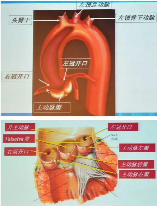 清晰完整揭秘冠脉造影全部过程,冠脉造影教学视频