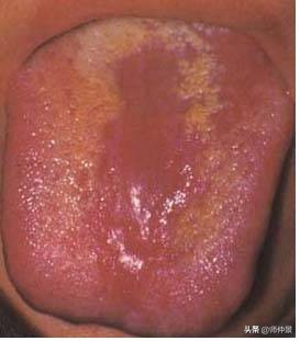 最实用的舌诊图六大舌象,舌诊深入学习书