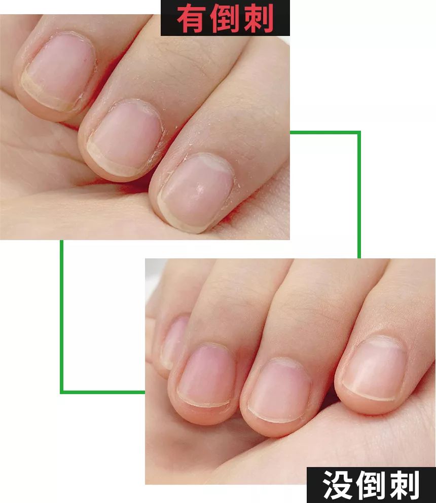 秋冬手干裂擦手霜,冬天手脚干裂涂什么护肤品