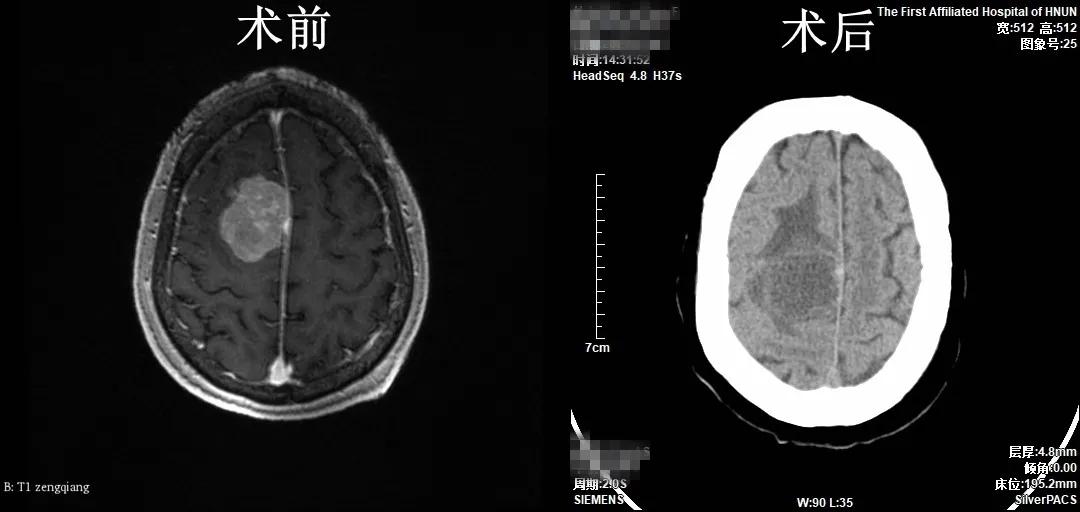 病例报道,医播报
