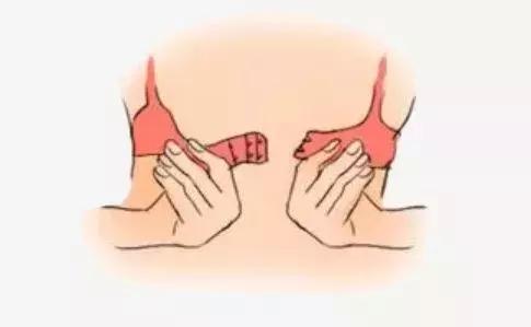 乳腺癌穿什么样的胸罩,乳腺癌女性穿什么胸罩