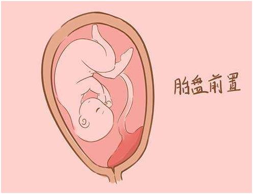 孕期发现出血需要做什么检查,孕期出血原因不明