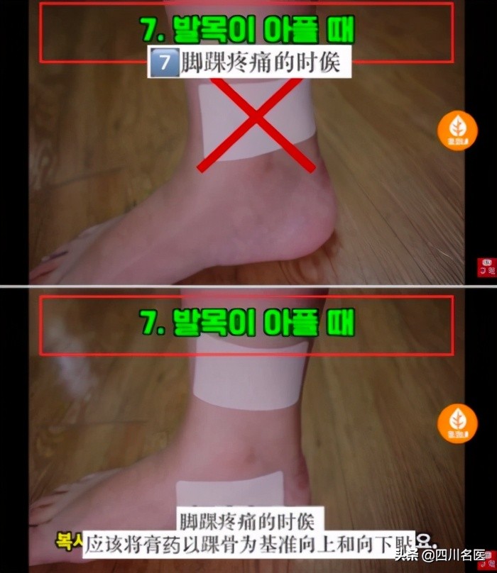 哪儿疼贴哪儿,膏药是不是哪儿疼贴哪儿