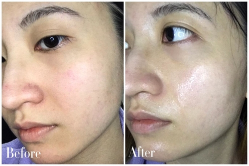 一张面膜让你皮肤好到爆,一片面膜能试出效果吗