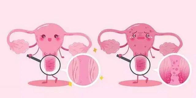 春季妇科疾病预防科普常识,妇科炎症小常识
