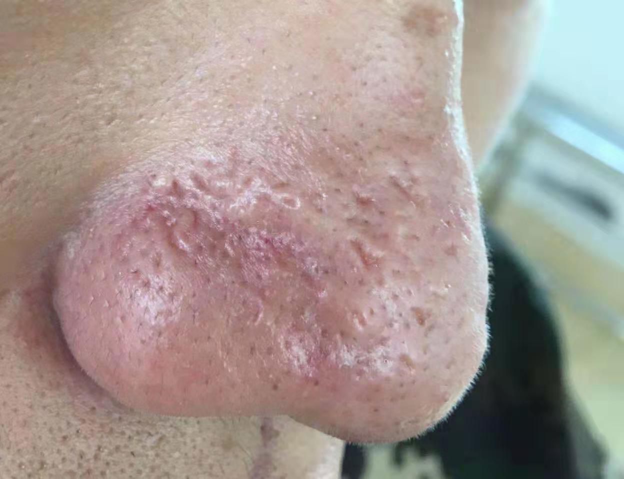 皮肤科医生经典小故事,皮肤科病例故事