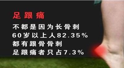 跖筋膜炎和足跟脂肪垫炎,足底筋膜炎怎么缓解疼痛