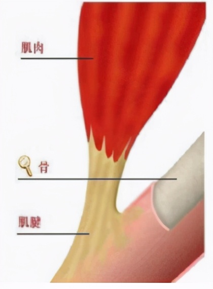 手指肌腱受伤伸不直多久手术合适,手指肌腱轻微损伤怎么治疗